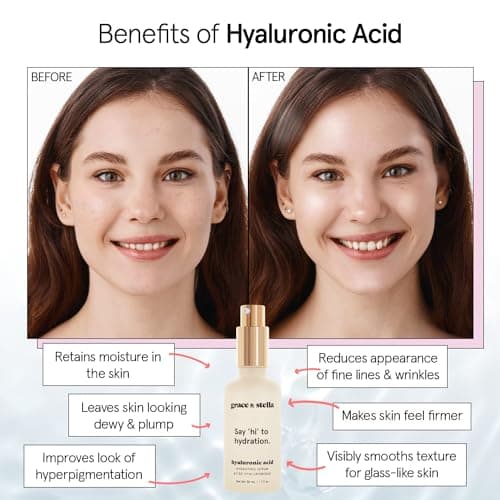 grace & stella Award Winning Hyaluronic Acid Serum for Face (50ml) Hydrating Hyaluronic Acid - Acide Hyaluronique Face - Anti Aging Serum to Hydrate, Remove Fine Lines, Wrinkles, Boost Collagen — view 2