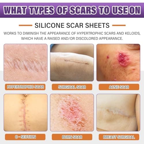 Silicone Scar Sheets, Medical Grade Silicone Scar Tape for Surgical, Hypertrophic, Keloid, C-Section, Burn, Old & New Scars, Reusable Professional Scars Removal Sheets (1.6"X 59" Roll-1.5M)