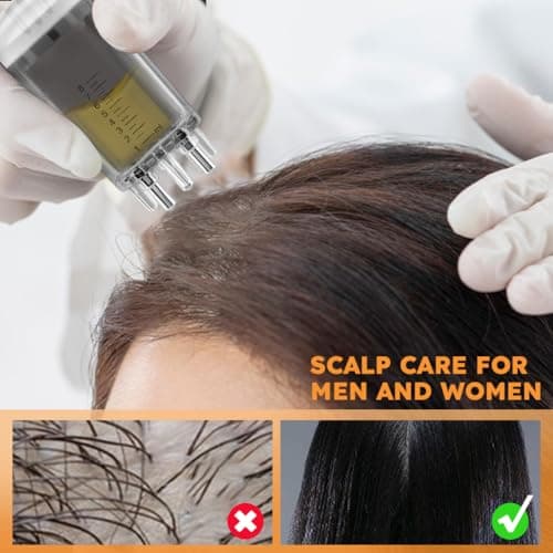 Minoxidil Applicator 2PCS – Easy Massage Scalp Comb & Brush Tool for Hair Serum — view 5