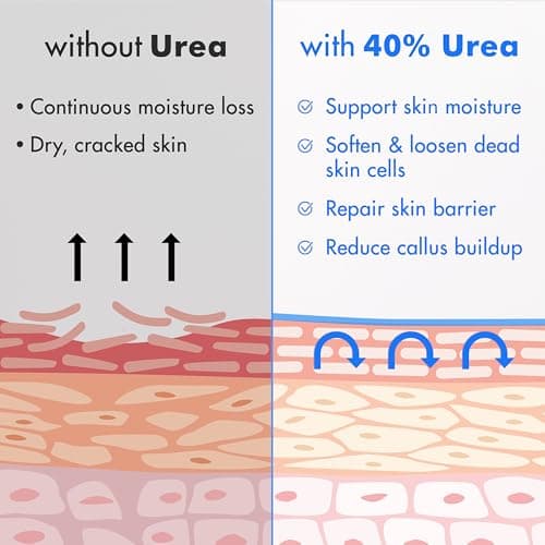 Ebanel Urea Cream 40% plus Salicylic Acid 2%, Foot Cream for Dry Cracked Heels Feet Knees Elbows Hands, Foot Dead Skin Cuticle Callus Remover Toenail Softener, Keratolytic Skin Barrier Repair — view 4