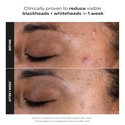 Paula's Choice SKIN PERFECTING 2% BHA Liquid Salicylic Acid Exfoliant, Daily Facial Exfoliator for Enlarged Pores, Wrinkles & Fine Lines, Fragrance-Free, Full Size - 118 ml — view 4
