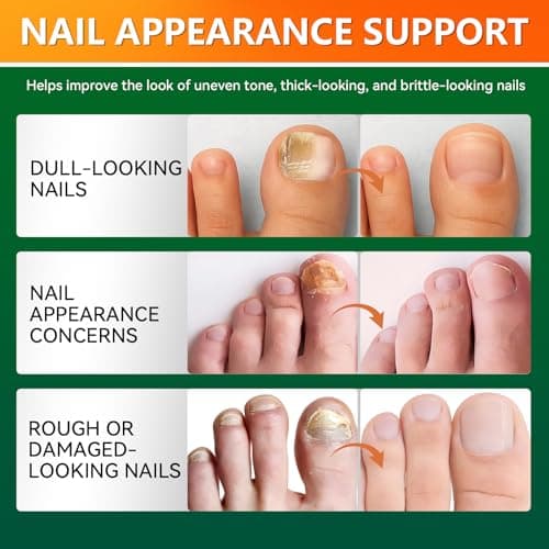 Toenail Fungus Treatment Extra Strength, Antifungal Nail Treatment with Tea Tree Oil, Menthol, Vitamin E & Pro-Vitamin B, 30ML — view 4
