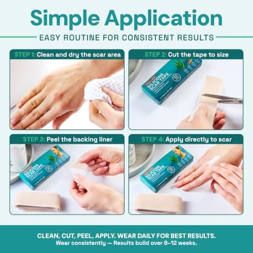 Scar Tape for Scar Treatment, Scar Patches, Silicone Scar Sheets Scar Patches for Surgical Scars, C Section Scar Silicone Strips, Silicone Tape Medical Grade Aloe Vera Scar Tape, for Face and Body — view 4