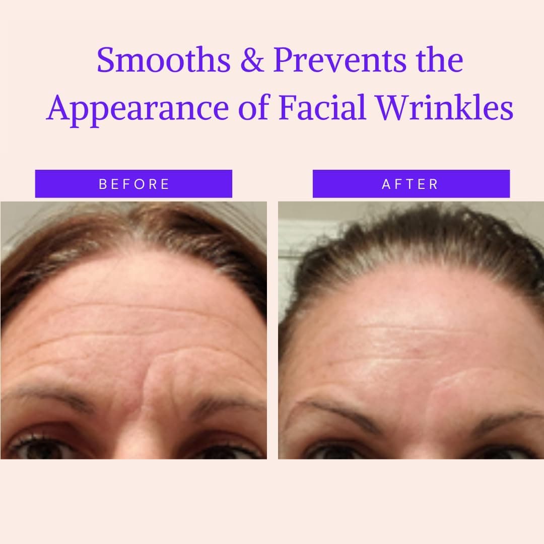 Parches Antiarrugas Pequeñas - Almohadillas para Suavizar e Hidratar la Piel de Ojos, Boca y Frente Durante la Noche - Antienvejecimiento, Anti edad, Alternativa al Botox (160 uds) — view 2