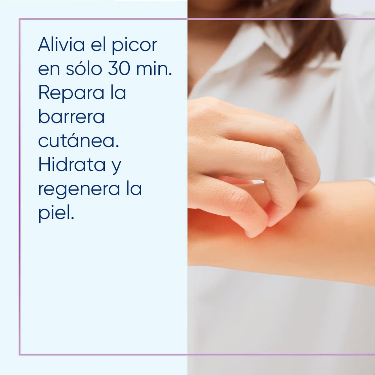 Bepanthol Derma SensiCalm para Aliviar el Picor y Enrojecimiento de las Irritaciones Cutáneas en Solo 30 Minutos, Sin Cortisona, 20 g — view 5
