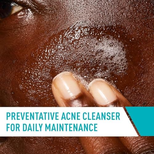 CeraVe Acne Treatment Face Wash, Salicylic Acid Cleanser with Purifying Clay, Niacinamide, and Ceramides, Pore Control and Blackhead Remover, 8 Ounce — view 3