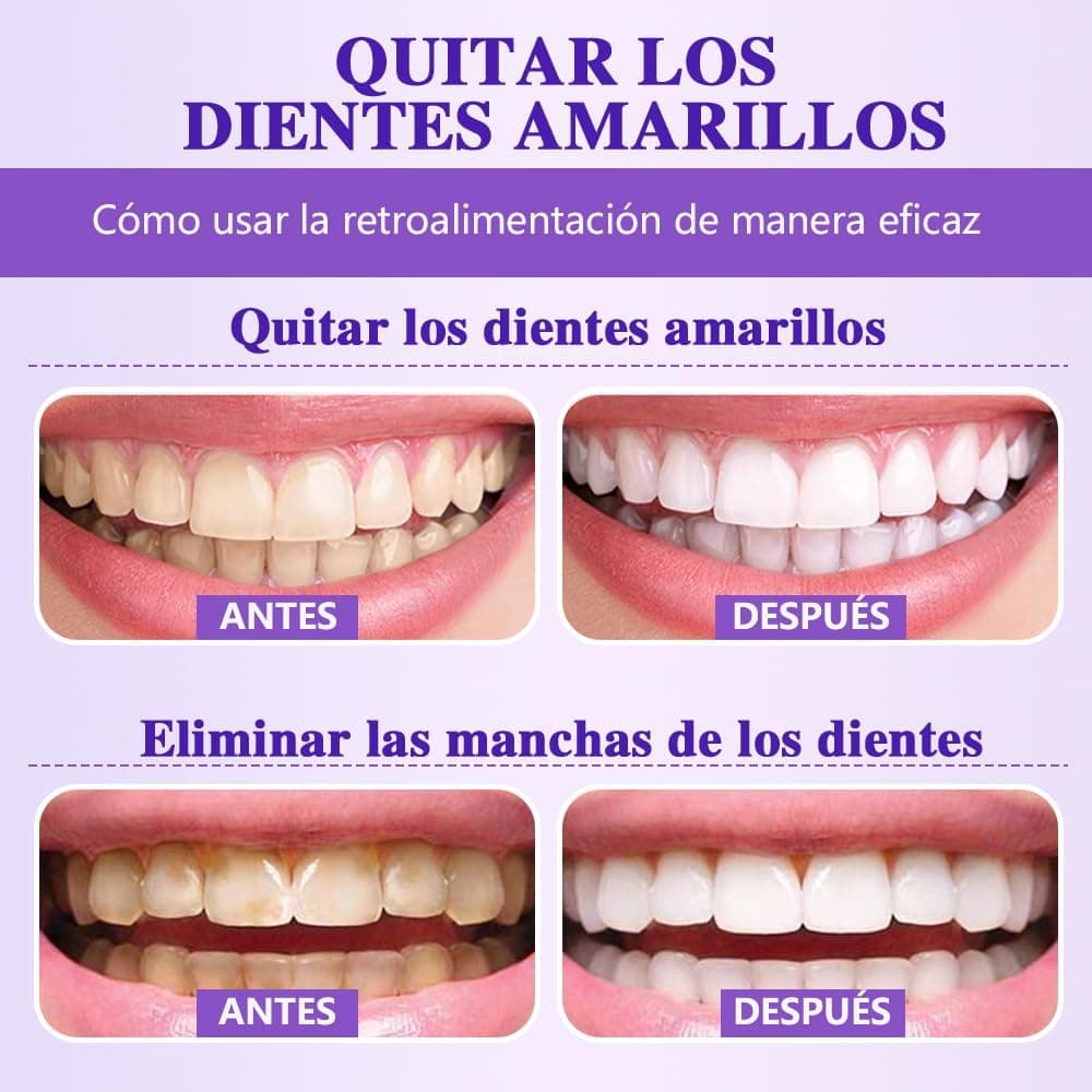 Professional Teeth Whitener Powder | Removes Years of Coffee & Tobacco Stains | Gentle Formula for Sensitive Teeth | Obsessive Whitening for Radiant Smile & Fresh Breath — view 5