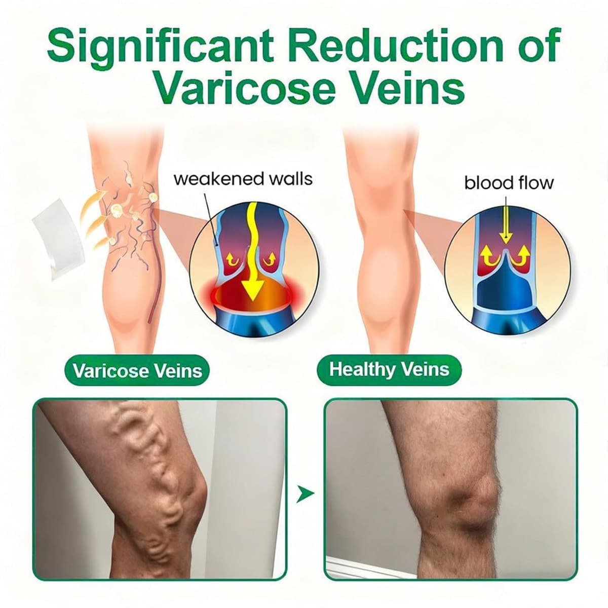 12 Unidades Target parche avanzado con para varices Parche con Microagujas para Venas Varicosas, Tratamiento Natural para Piernas, Apto para Todo Tipo de Piel (8PC+Verde) — view 3