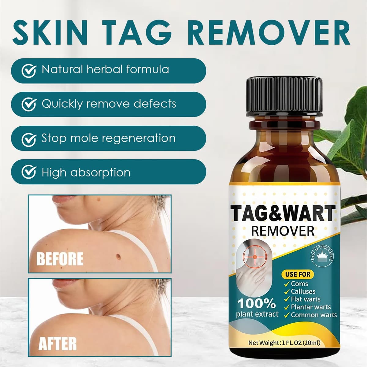 30ml SolucióN Anti-Verrugas, AplicacióN Precisa En Puntos EspecíFicos, Restaurar La Suavidad De La Piel, Manos Y Pies — view 2