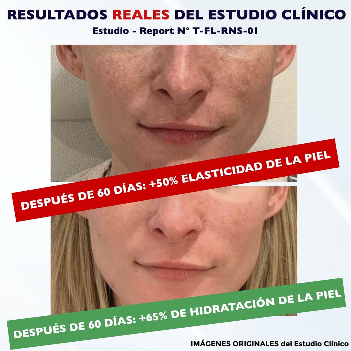 100 ml. Bio Crema Hidratante al Retinol para la Cara y Contorno de Ojos. Crema Facial Mujeres y Hombres Anti-Edad Antiarrugas y Antiojeras con Ácido Hialurónico y Vitamina C. Crema de Noche y Día — view 4