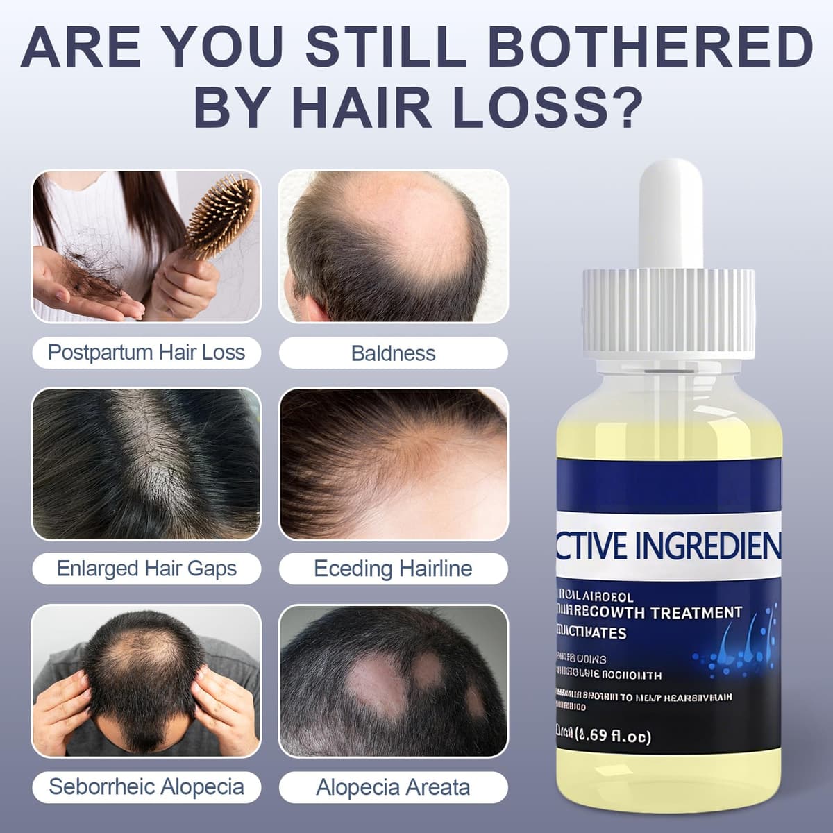 2 Piezas 50ML Serum Anticaida para el Cabello, Nutre el Cuero Cabelludo, Fortalece el Cabello, Nutre el Acelerar Crecimiento del Cabello, Fácil de aplicar para Hombres y Mujeres — view 3