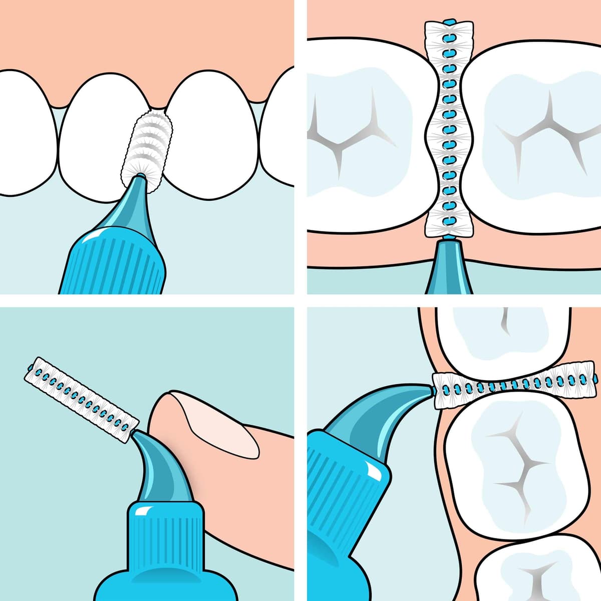 TePe Interdental Brush, Original, Yellow, 0.7mm/ISO 4, 8pcs, efficient Cleaning Between Teeth, Plaque Remover and Dental flosser for Small Gaps — view 5