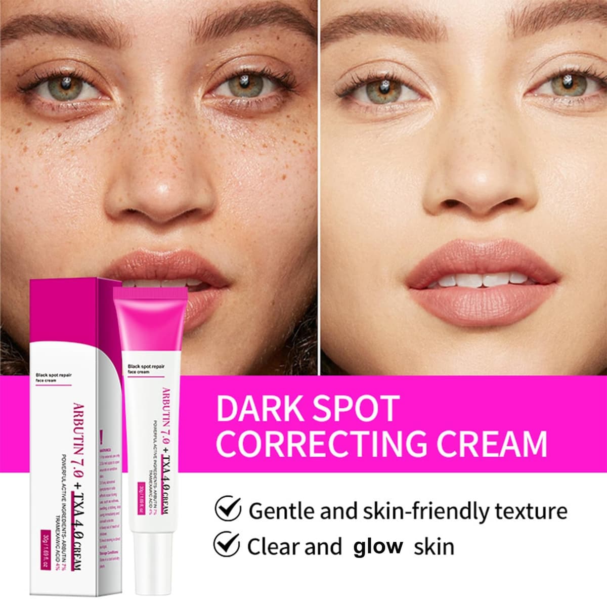 Arbutin 7% + ácido tranexámico 4% crema – Dark Spot Remover Skin Lightening Cream, Eliminador de manchas de pigmentación facial – Crema Glow Skin contra manchas de pigmento, pecas e imperfecciones — view 2
