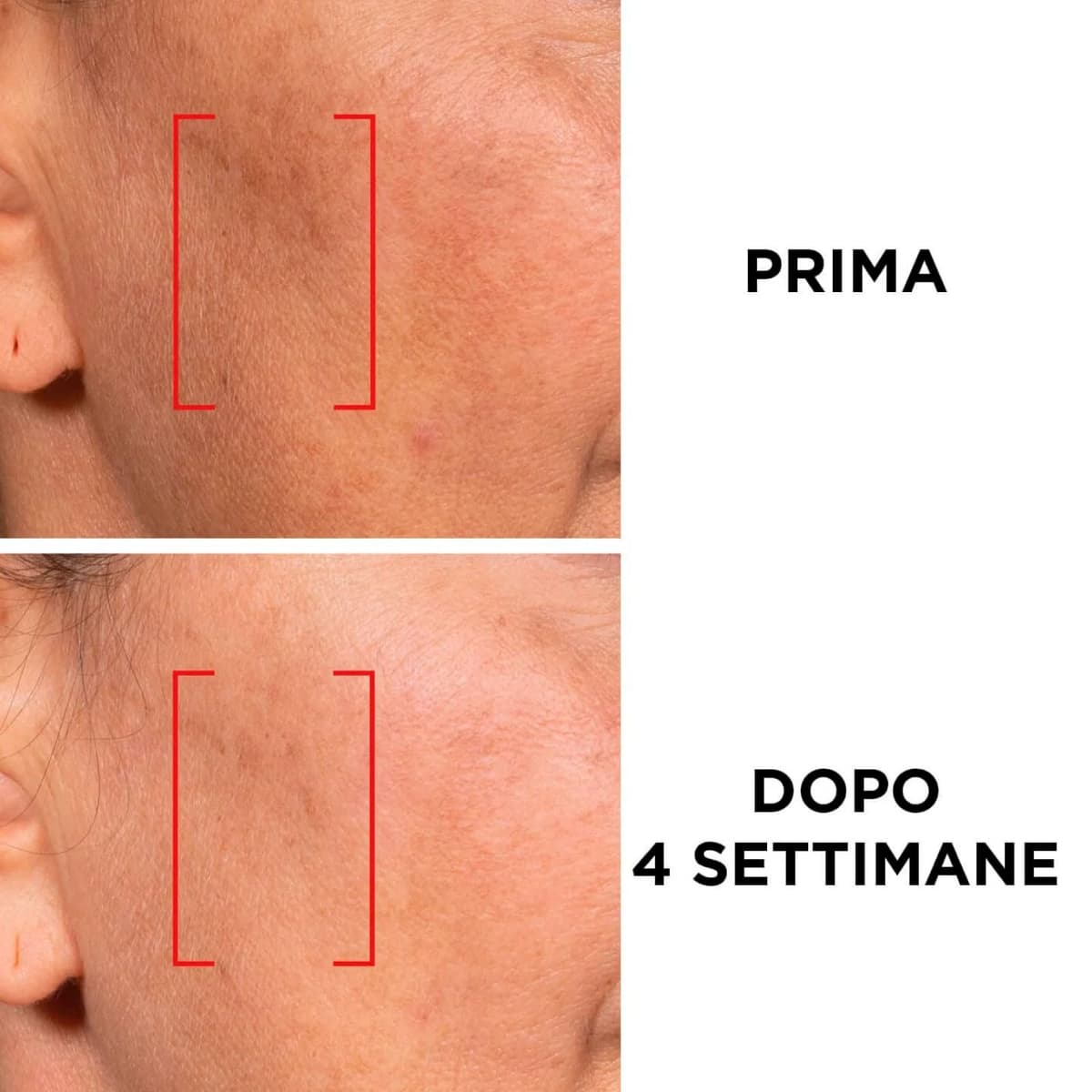 L'Oréal Paris Revitalift Laser Tratamiento Antiedad Profundo SPF 25 Crema de Día y Crema de Noche - 2 Botes de 50ml — view 2
