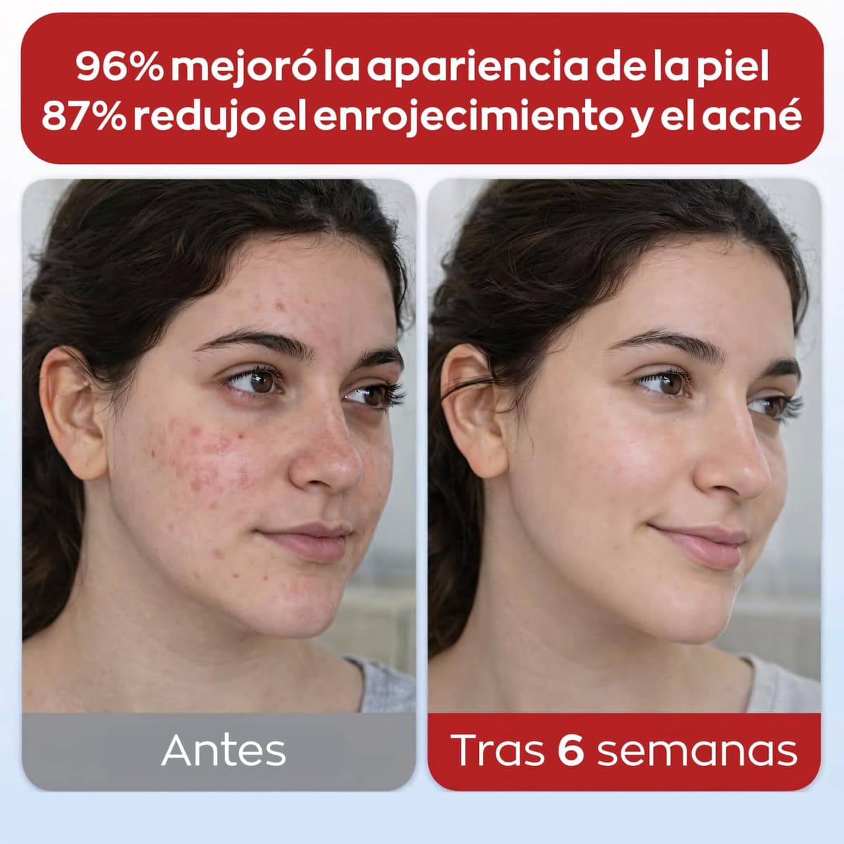 Pack x70 Toallas Desechables Faciales – 100% Origen Natural, Toallas Faciales Desechables, Toallitas Desmaquillantes, Toallitas Faciales Desechables, Toallas Limpias, Anti-Acné, Face Towels XL 26x30cm — view 4