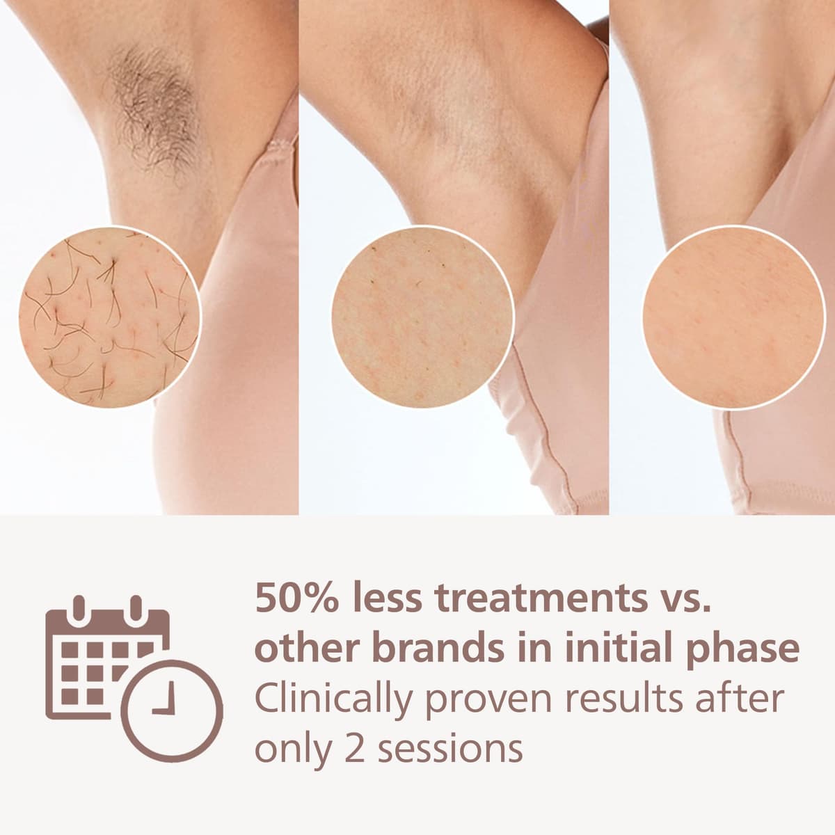Philips Lumea 7000 Series, IPL Hair Removal Device, Laser Hair Removal Alternative, with Satin Compact Pen Trimmer, 3 Attachments for Body, Face and Bikini, Model BRI923/00 — view 4