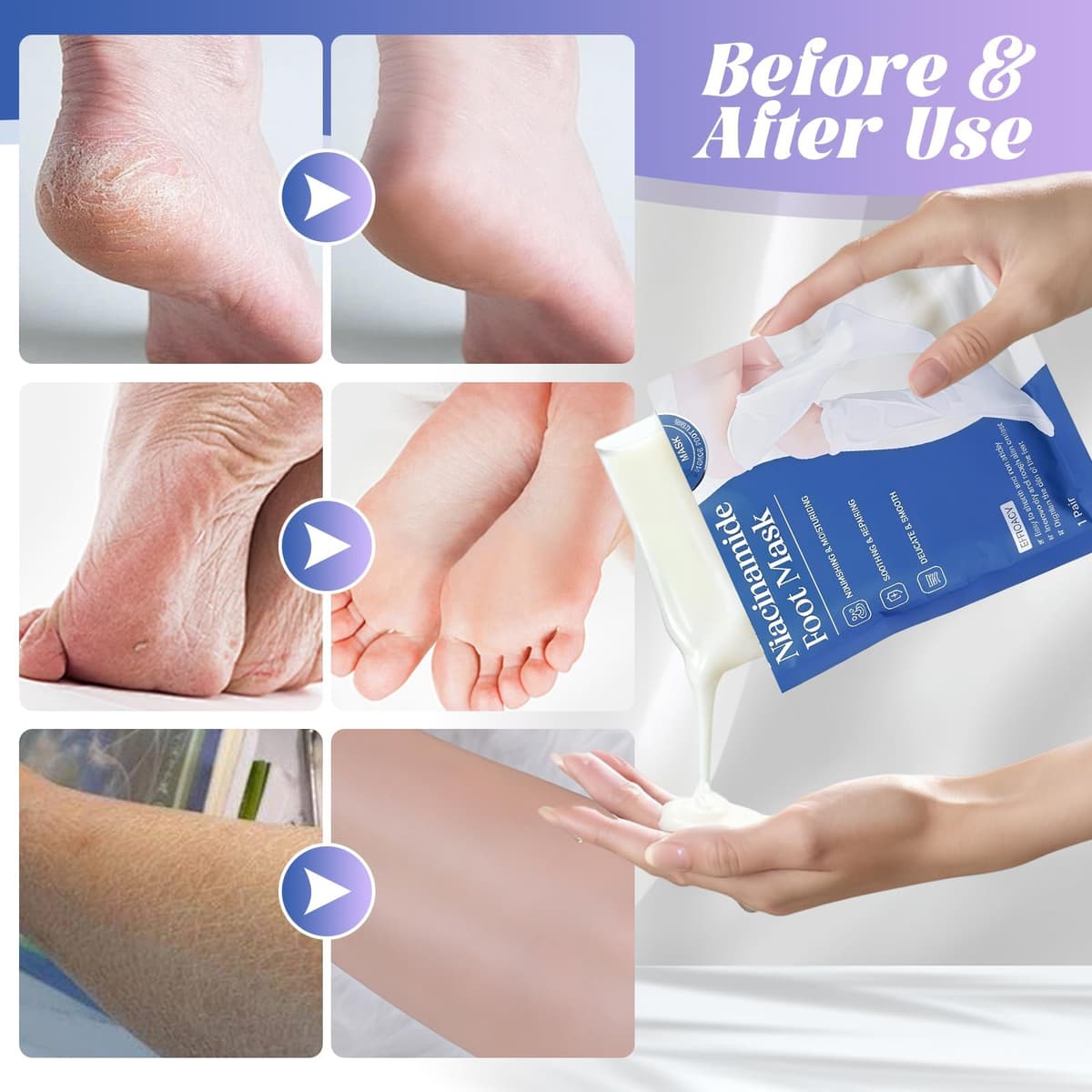 3 Pares Foot Peel Mask Exfoliante e Hidratante para Pies, Calcetines de Cuidado con Leche, ayuda a eliminar piel muerta, para pies secos, ásperos y talones agrietados, para mujeres y hombres — view 3