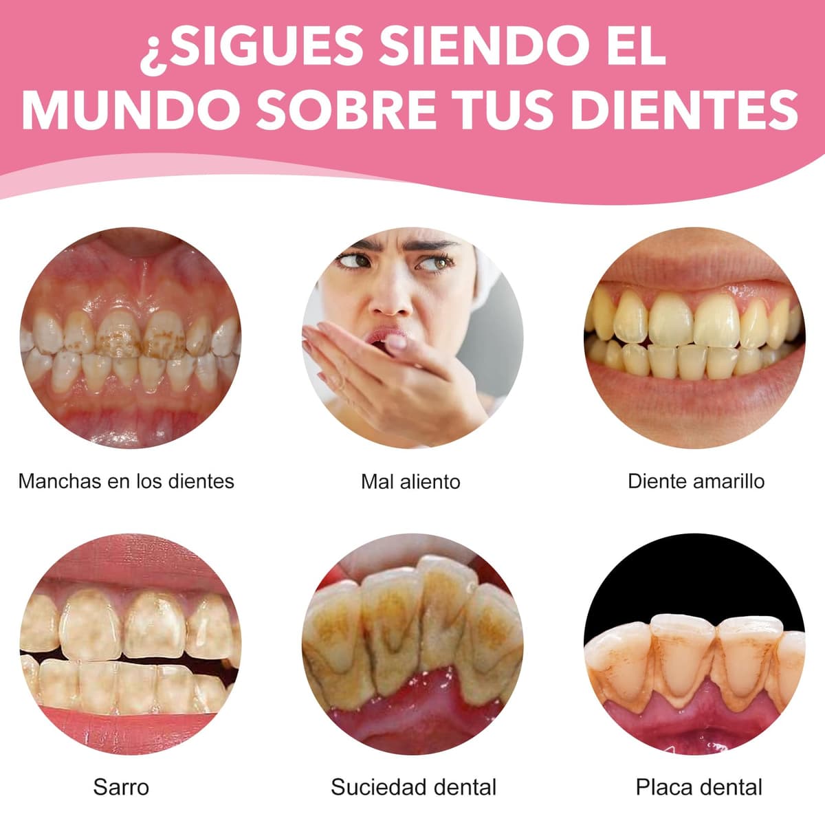 Blanqueador Dental Profesional,Polvos Blanqueadores Dientes,Blanqueamiento Dental Eliminación Profunda de Manchas,Eficaz Para Fortalecer Dientes y Encías,Suave Para Dientes Sensibles(white) — view 4