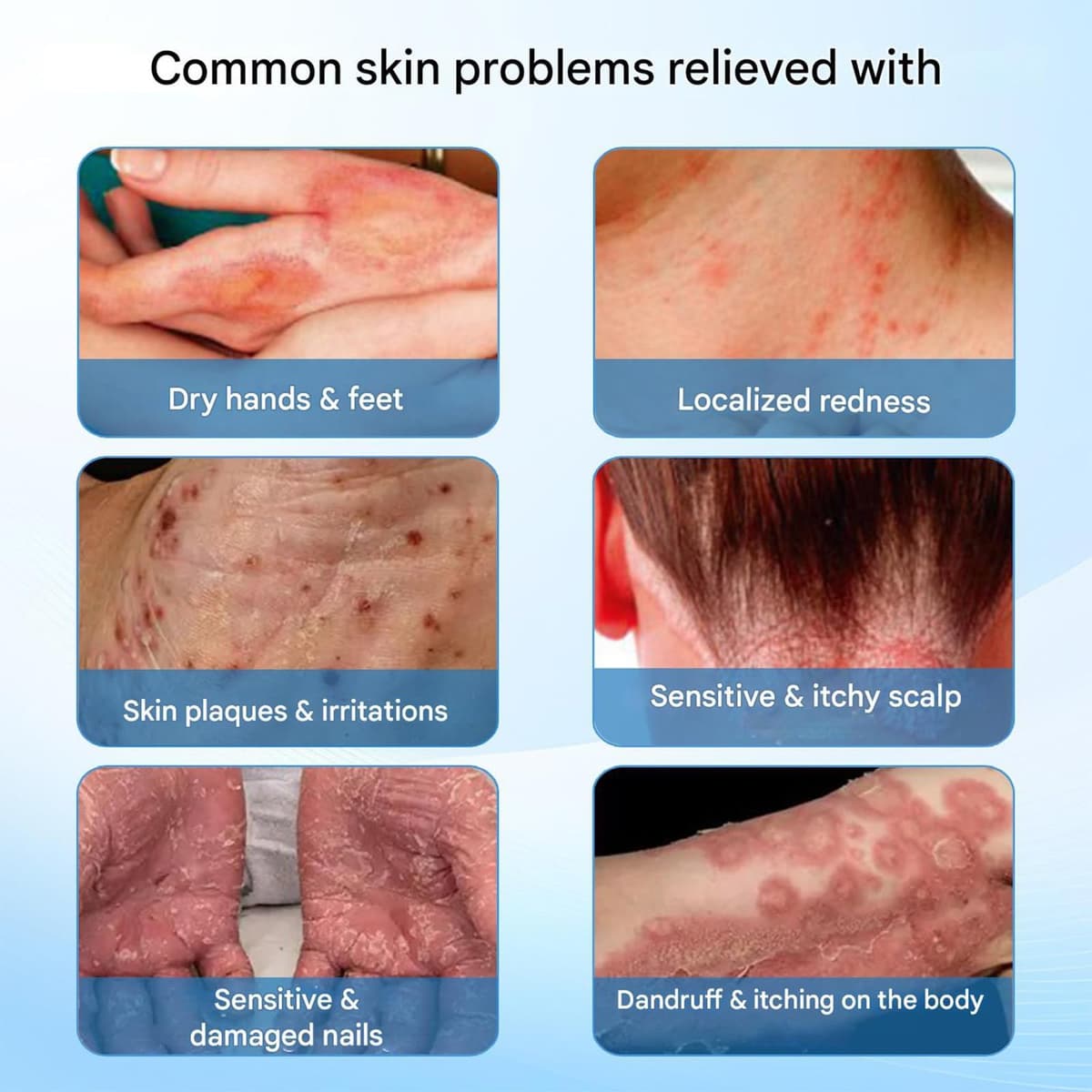 Lumaqo Crema Barba Dermatitis,Hidratación Natural,Fórmula Suave Para Pieles Sensibles Y Secas,Para Todo Tipo De Piel (1 Caja) — view 4