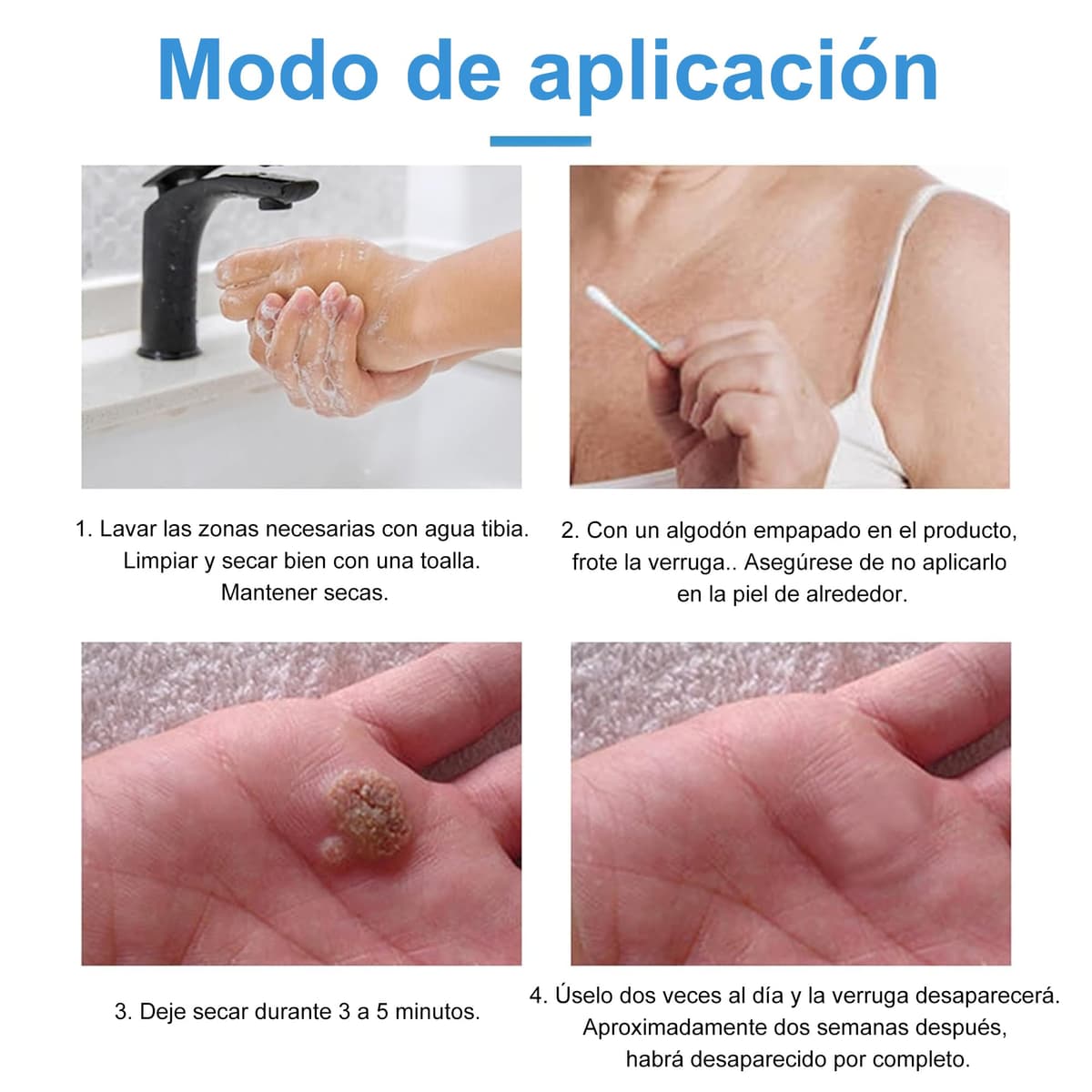 Crema para eliminar verrugas y acrocordones, kit para rostro y cuerpo, eliminación suave de verrugas plantares, comunes, callos y planas, 20 g — view 6