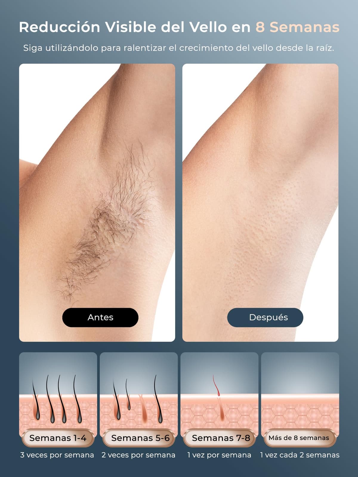 21J Depiladora Laser con Función de Refrigeración, 600-1200NM Depiladora Luz Pulsada con 9 Niveles de Energía, Pantalla Táctil LCD para Mujer y Hombre, Bikini, Axilas, Cara, Cuerpo Blanco — view 7