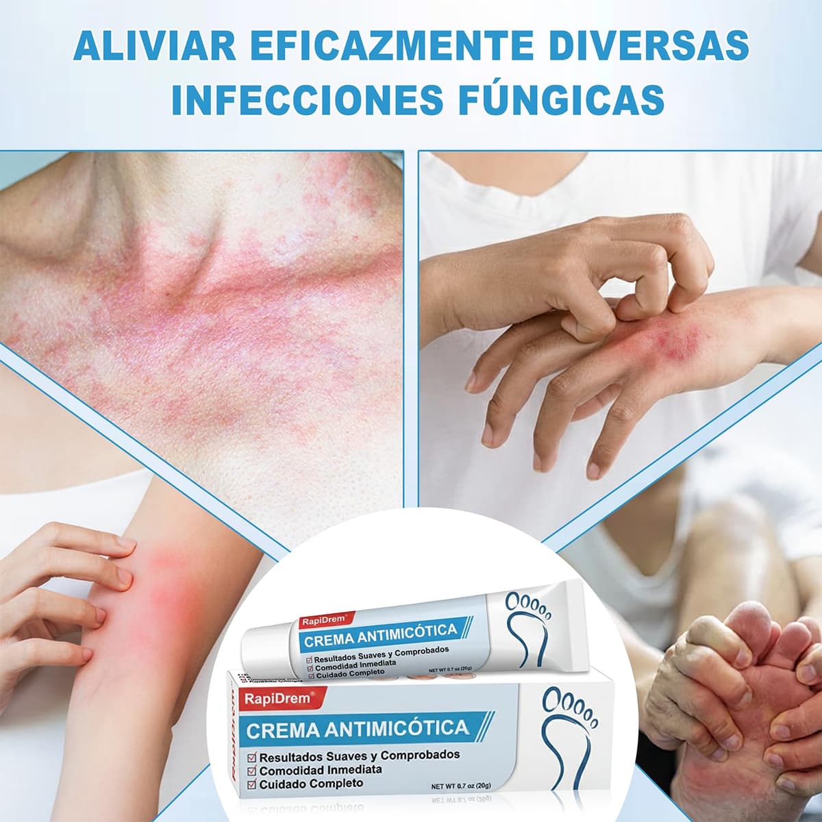 Crema Antifúngica - Crema Antifúngica para la Piel, Crema antimicótica para hongos pies y pie de atleta Calma los picazones y el malestar cutáneo, fórmula natural (1) — view 5