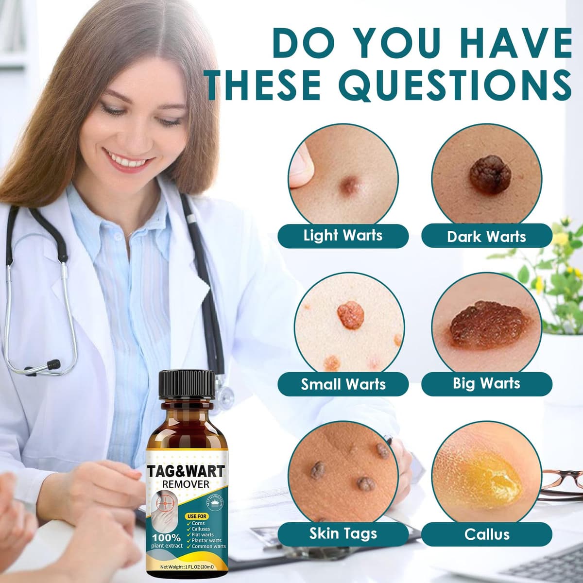 30ml SolucióN Anti-Verrugas, AplicacióN Precisa En Puntos EspecíFicos, Restaurar La Suavidad De La Piel, Manos Y Pies — view 5