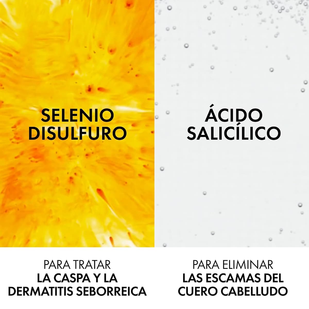 Vichy Champú Anticaspa, Cabellos Grasos, Elimina la Caspa y Reduce los Picores, Cuero Cabelludo Limpio y Sano, Doble Eficacia, Unisex, Dercos Technique, 390 ml — view 3
