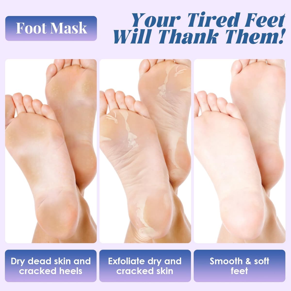 3 Pares Foot Peel Mask Exfoliante e Hidratante para Pies, Calcetines de Cuidado con Leche, ayuda a eliminar piel muerta, para pies secos, ásperos y talones agrietados, para mujeres y hombres — view 2