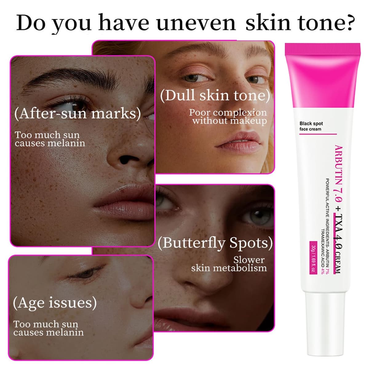 Arbutin 7% + ácido tranexámico 4% crema – Dark Spot Remover Skin Lightening Cream, Eliminador de manchas de pigmentación facial – Crema Glow Skin contra manchas de pigmento, pecas e imperfecciones — view 4