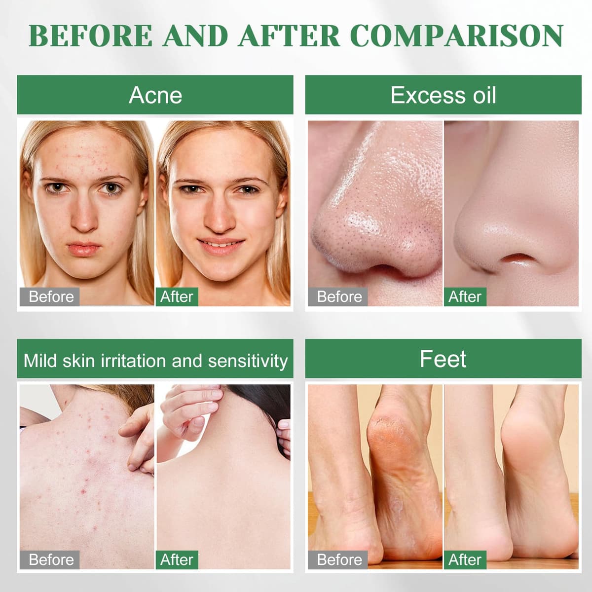 2 Pastillas de JabóN de Aceite Árbol De Té, Jabón Natural de Arbol de Té con Redes de Espuma, Limpiador Facial y Eliminar el Olor Corporal, Jabon de Cara Cuerpo para Hombres Mujeres Toda la Piel — view 5