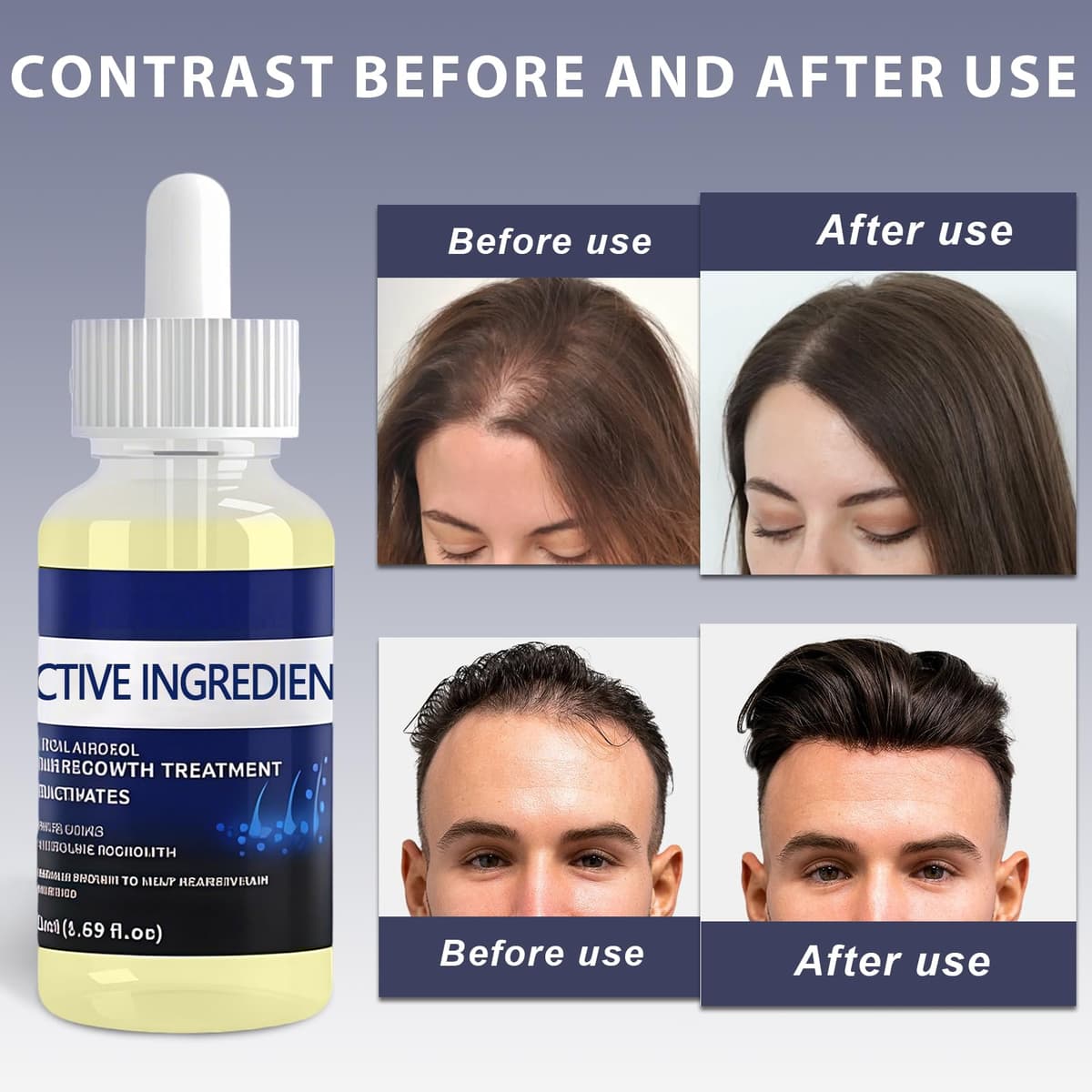 2 Piezas 50ML Serum Anticaida para el Cabello, Nutre el Cuero Cabelludo, Fortalece el Cabello, Nutre el Acelerar Crecimiento del Cabello, Fácil de aplicar para Hombres y Mujeres — view 4