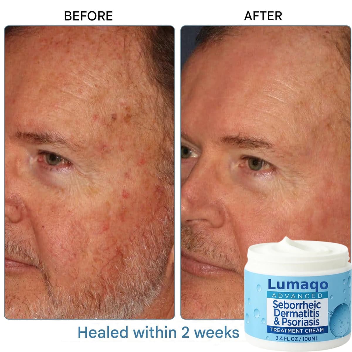 Lumaqo Crema Barba Dermatitis,Hidratación Natural,Fórmula Suave Para Pieles Sensibles Y Secas,Para Todo Tipo De Piel (1 Caja) — view 2