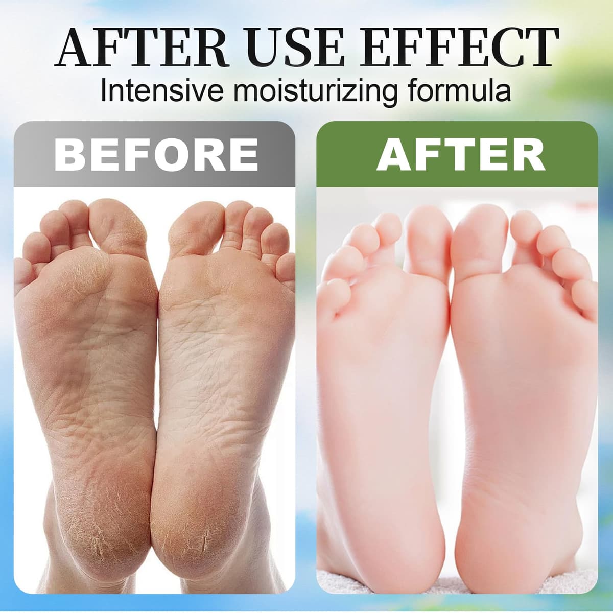 3 Pares Mascarilla Pies Exfoliante y Hidratante, Calcetines Exfoliantes de Pies para Eliminar Durezas y Callos, Peeling Pies Profesional para Pies Suaves, Coco, Lavanda, Aloe Vera — view 2