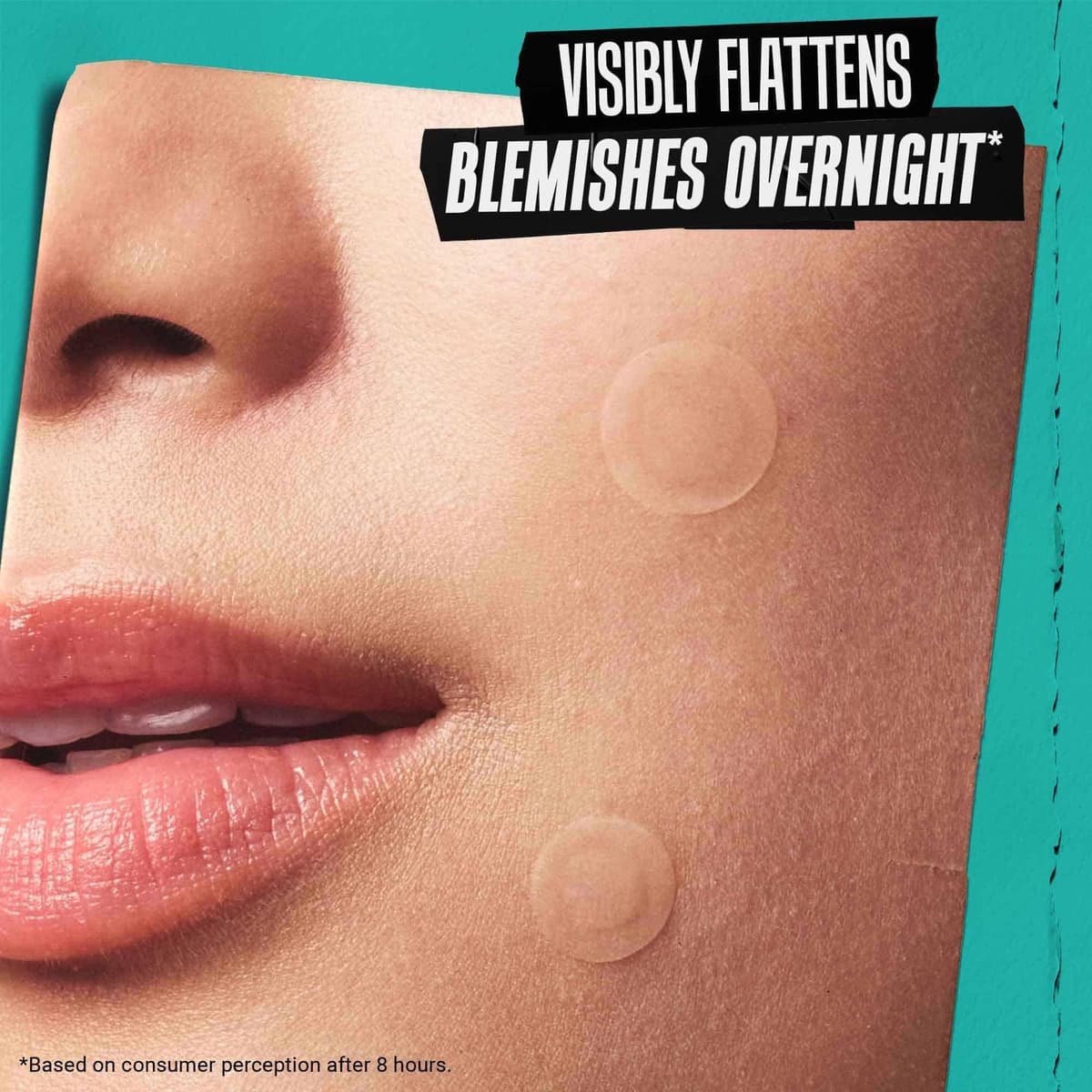 Kiehl's Truly Targeted Overnight Blemish Patch, Hydrocolloid Patch for Blemishes — view 3