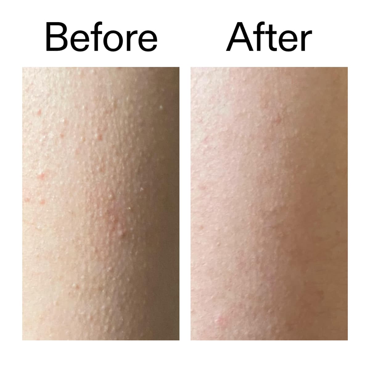 The INKEY List Glycolic Acid Exfoliating Body Stick 45g, Multiple Concerns, One Targeted Solution, Delivers Deep, Effective Exfoliation, Fragrance Free, Suitable For All Skin Types — view 7