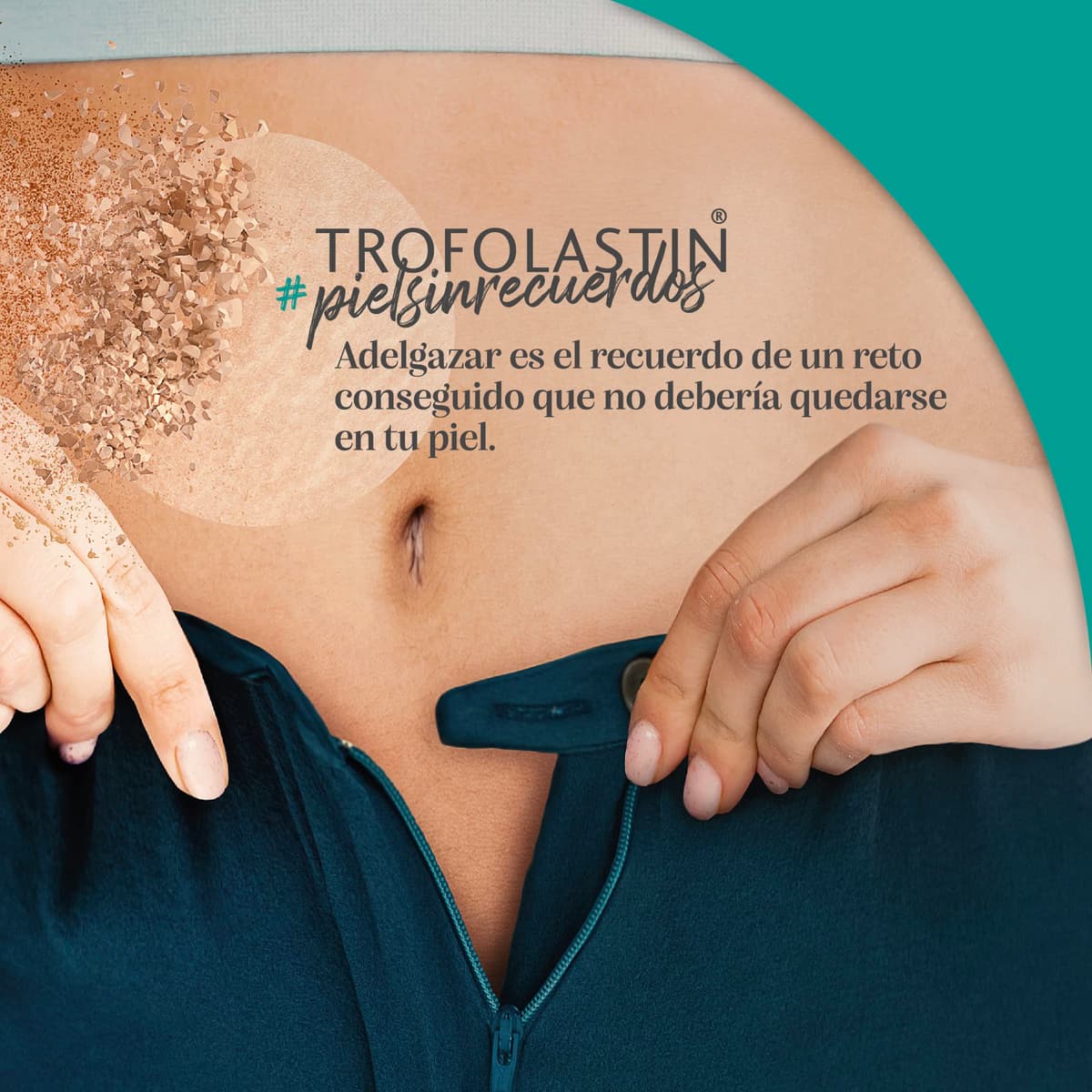 Trofolastin, Crema Antiestrías Reafirmante, Hidratación y Prevención de Estrías, Con Centella Asiática, Piel Flexible y Elástica, 250ml — view 8