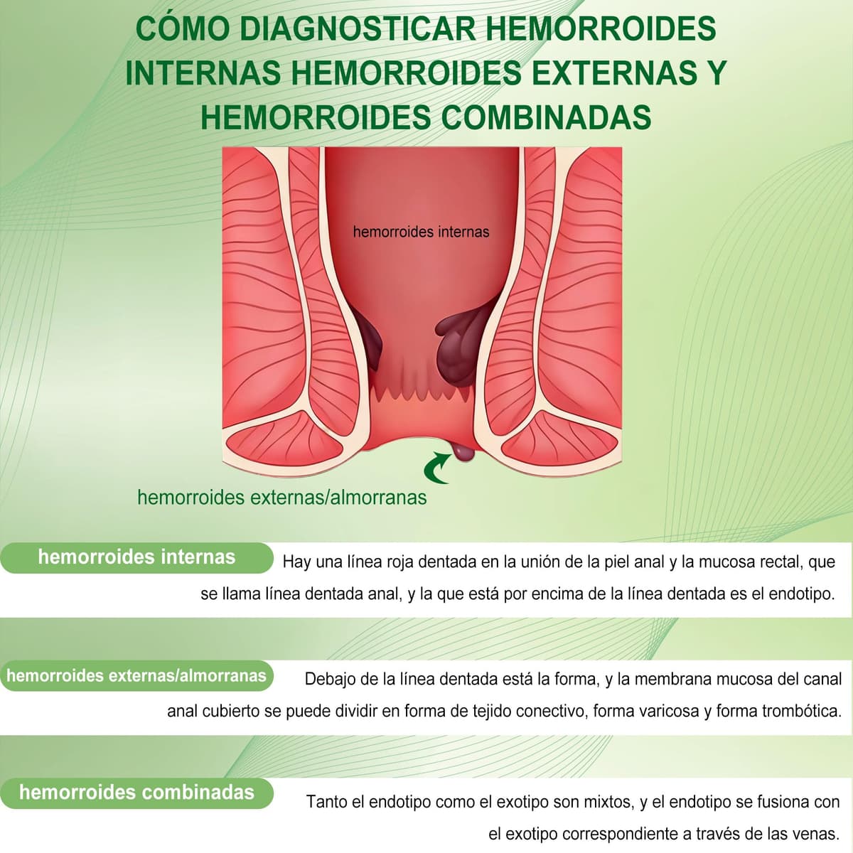 Hemorrhoid Relief Cream, Suitable for Relieving Pain, Swelling, Itching and Bleeding, Protecting Delicate Skin (20G 1-Pack) — view 4
