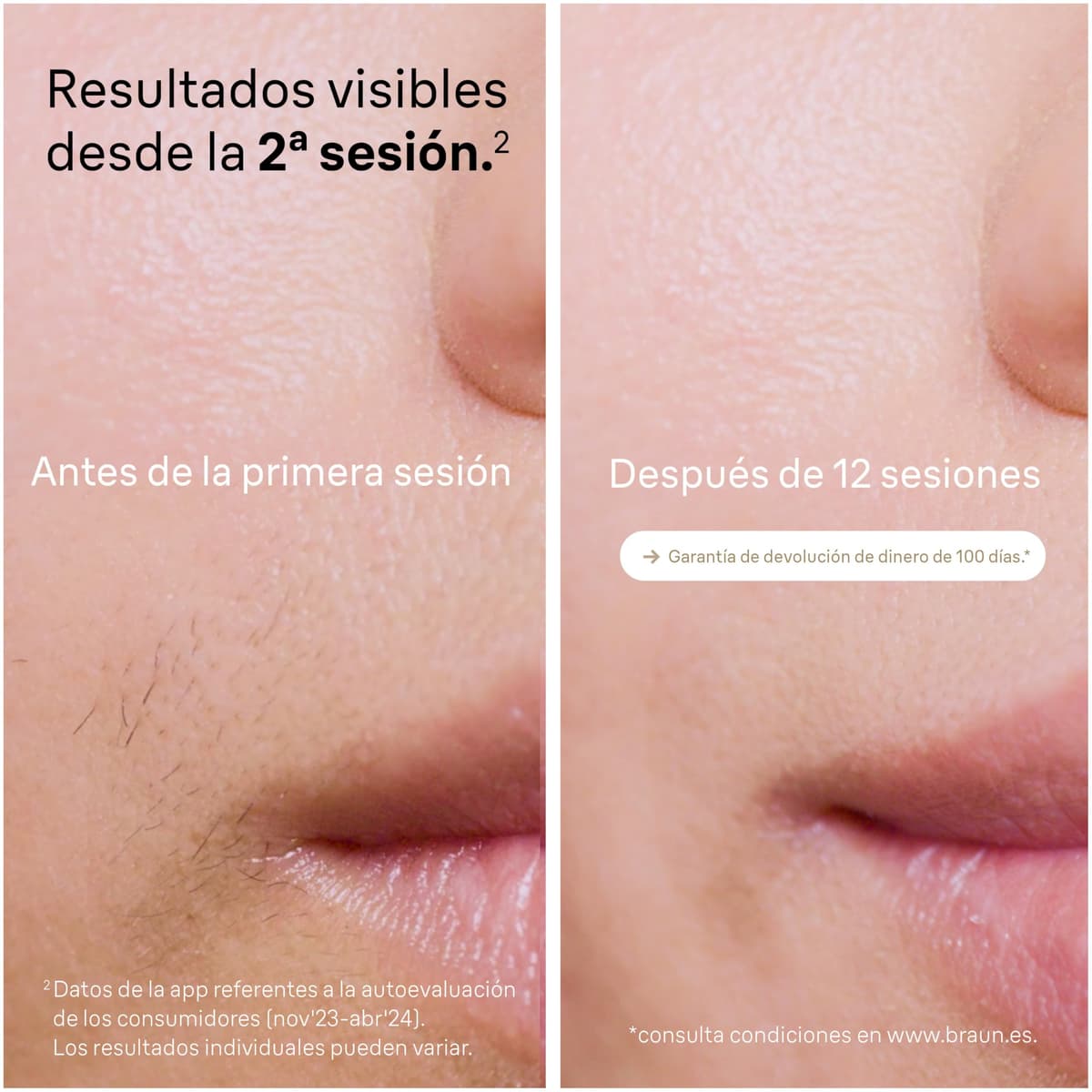 Braun Luz Pulsada Silk·expert Pro 5, PL5382, Blanca/Dorada - Alternativa a Depiladora Laser, Eliminación del Vello en Casa, Depiladora IPL con Funda, Maquinilla Venus, 4 Cabezales para Cara Y Cuerpo — view 4
