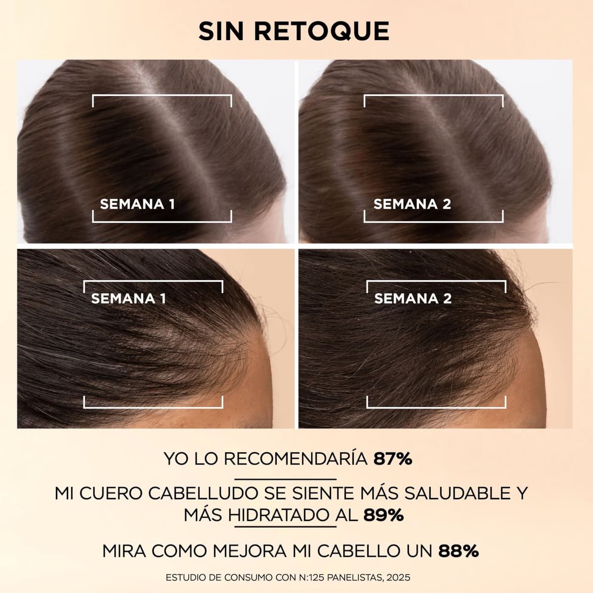 Pantene Grow Abundant Sérum Anticaída para el Cuero Cabelludo 60ml para un Cabello Más Grueso,Más Largo y Más Denso en 8 Semanas. Tratamiento Anticaída Cabello Mujer.Con 3000mg de ComplejoPro-Vitamina — view 3