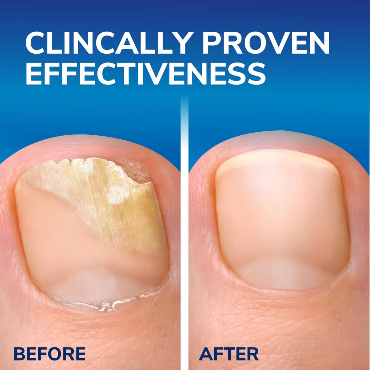 Scholl Fungal Nail Treatment 3.8ml,packaging may vary — view 9