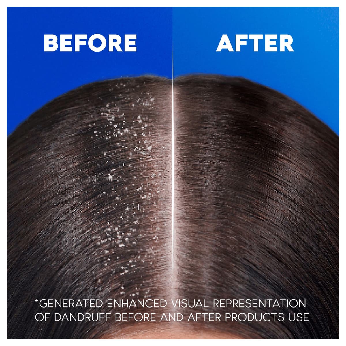 Head & Shoulders Classic Clean 2in1 Anti Dandruff Shampoo, 1000ml. Up to 100% Flake Free, Clinically Proven. For Any Hair and Scalp Type. For Daily use. Clean Feeling — view 5